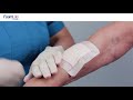 Foam Lite™ ConvaTec Application - Skin Tear Mid Forearm