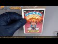 SNC Grading:1985 Topps Garbage Pail Kids Blasted Billy #8b​​​​​​​​​ Series 1 Review (1619534408851)