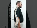 What Is The Natural Shape Of The Spine?