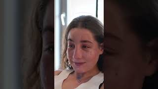 Beauty Journey from Dublin to Antalya | Matea’s Rhinoplasty at Cayra Clinic