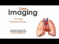 CT anatomy of the chest (DRE) Prof. Mamdouh Mahfouz