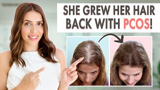 How Stephanie Grew Her Hair Back | Her PCOS Hair Loss Journey & Treatment!