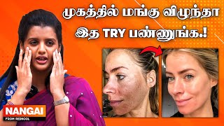 இந்த விஷயங்கள் MELASMA-வ அதிகமாக்கும்.. 😲 Dermatologist Dr. Poornima MD Explains | மங்கு | Nangai