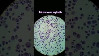 Trichomonas Vaginalis under microscope#parasitology #microscopy#Sexuall transmitted parasite