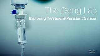 Genomic Mutations, Treatment-Resistance & Prostate Cancer - The Deng Lab at Yale School of Medicine