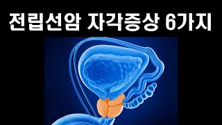 (Kor sub) 전립선암 자각 증상 6가지