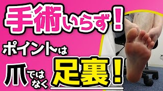 【巻き爪ケア】切らない！痛くない！なぜ足指で良くなるのか？【足指ほぐし】