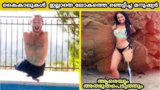 കൈകാലുകൾ ഇല്ലാതെ ലോകത്തെ ഞെട്ടിച്ച മനുഷ്യർ/People without Limbs Who Shocked The World/top10malayalam