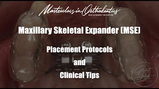 Maxillary Skeletal Expander | MSE | Jaw Expansion | Placement Procedure | Clinical Protocol and Tips