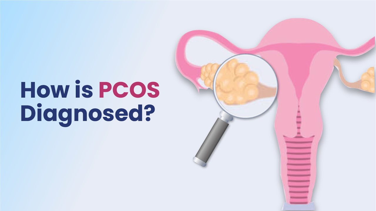 How Is PCOS Diagnosed? | PCOS Diagnosis | MFine - YouTube