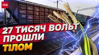 ПІДЛІТОК СПАЛАХНУВ! 27 ТИСЯЧ ВОЛЬТ ПРОШИЛИ ШКОЛЯРА! РЕЗОНАНСНИЙ ВИПАДОК