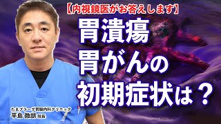 胃潰瘍や胃がんの初期段階ってどんなの？　胃が痛むんですか？　教えて平島先生