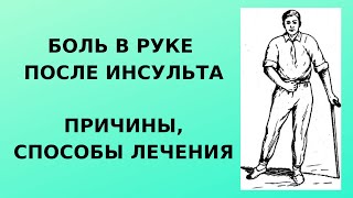 Боль в руке после инсульта