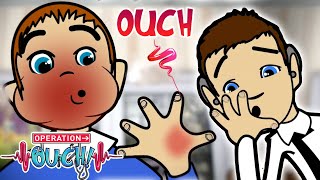 I Burnt My Hand!🔥  ✋ ☕  | Clip | Science For Kids | @OperationOuch​