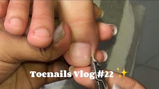 Toenails Vlog #22