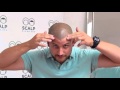 New York Scalp Micropigmentation- Eric's Testimonial- Scalp Micro USA