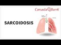 Sarcoidosis