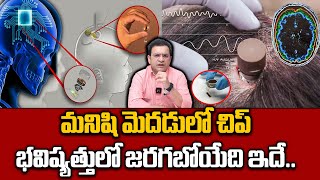 Dr Movva Srinivas : మనిషి మెదడులో చిప్.. | First Brain Chip Implant In Human | Elon Musk | Neuralink