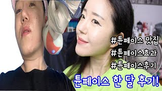 튠페이스 한 달 후기, 튠페이스 효과, 이건 대박, 리프팅 실패한 사람 내게로 오라. 제일 안 아팠던 효과 좋은 리프팅, 튠페이스 맛집 여기야