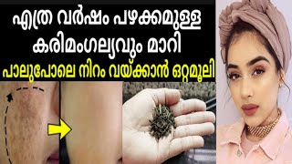 കരിമംഗല്യം മാറാൻ ഇതിനേക്കാൾ നല്ല വഴി ഇനി സ്വപ്നങ്ങളിൽ മാത്രം