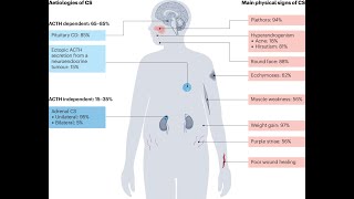 Ectopic ACTH Syndrome (Ectopic Adrenocoticotropic Hormone Syndrome) ; Definition, Causes, Symptoms