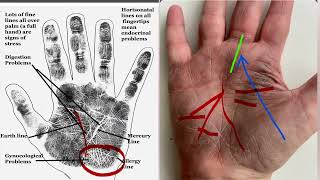 Palmistry and medical sciences I Health Palmistry truth #palmistry #astrology #hasthrekha #health