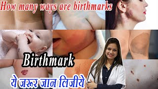 Types of Birthmarks || कौन से बर्थ मार्क नुकसानदेह है जरूर जान लिजीये | Dr Suman Agarwal
