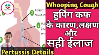 Whooping Cough !  Pertussis!  हुपिंग कफ किसे हो सकता है? ईलाज क्या है? पूरी जानकारी।