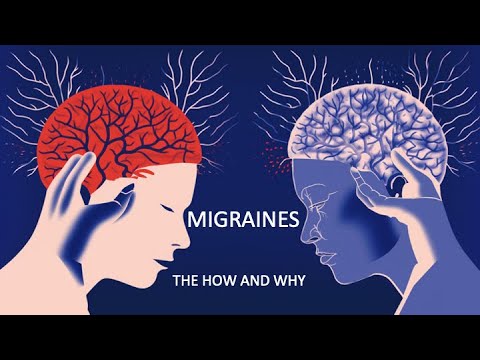 The Science Behind Migraines: Scientific Animations Explains The Hows ...