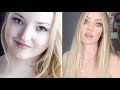 DOVE CAMERON - THE TRUTH BEHIND THE GLOW UP. PLASTIC SURGERY