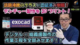 【総義歯を3Dプリント！】話題のクラスⅡ認証済み樹脂、フリープリント デンチャーとテンプを使って一気通貫で製作工程をご紹介【exocadでデザイン】