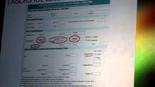 Rethinking corneal astigmatism: and toric IOL selection by Dr. Douglas D. Koch