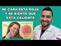 Mi cara esta  roja y caliente / Rosacea / Rinofima | DR. DAVID CAMPOS