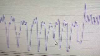 Trying out a pure-javascript WebSerial Plotter in Chrome