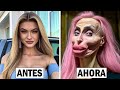 8 Cirugías Plásticas Que Salieron Demasiado Mal | ANTES Y DESPUES