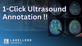 Revolutionizing Healthcare: Manual vs. Automated of Scans with Labellerr