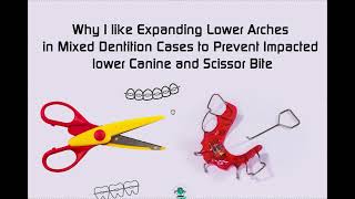 Why I Simultaneously Expand Lower and Upper Arches in Mixed Dentition Cases to Avoid Scissor Bite