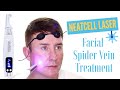 Neatcell Picosecond Laser Spider Vein Treatment | TJtutorials