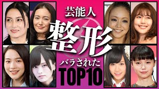 【全員じゃん】整形がバラされてしまった女性芸能人衝撃度TOP10