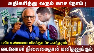 அதிகரித்து வரும் காச நோய் ! |டைனோசர் நிலைமைதான் மனிதனுக்கும்| பகிர் உண்மையை விளக்கும் Dr. காந்தராஜ்