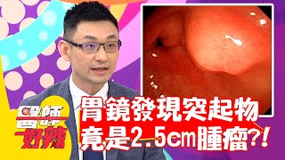 胃鏡檢查發現突起物，竟是2.5公分腫瘤？！【#醫師好辣】20210518 part1 EP1151 鄭丞傑 吳昭寬