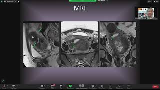 Challenging Cases - Prof. Heba Hassan - Part 2