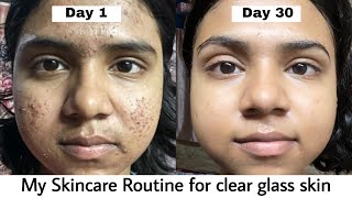 My Skincare Routine for Glass Skin | 30 days clear skin challenge | Acne Treatment | #skincare
