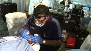 NeoGraft Explanation