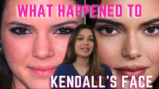 What Happened to Kendall Jenner’s Face | The EVOLUTION of the Natural Kardashian