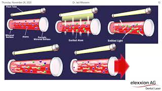 Ứng dụng nâng cao của laser trong nha khoa -Advanced Introduction of Dental LASERs