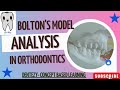 BOLTON'S ANALYSIS ||MODEL ANALYSIS || space analysis||   CONCEPT BASED LEARNING #BDS# Orthodontics