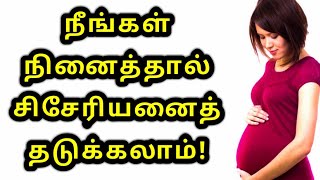 நீங்கள்   நினைத்தால்  சிசேரியனைத்  தடுக்கலாம்!