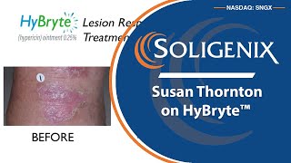 Soligenix; Cutaneous Lymphoma Foundation CEO Susan Thornton on HyBryte™