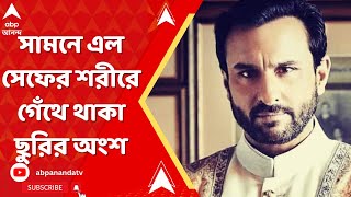 Saif Ali Khan: সামনে এল সেফের শরীরে গেঁথে থাকা ছুরির অংশ | ABP Ananda Live